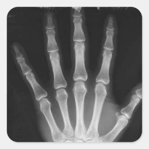 B&W Röntgen Skeleton Hand Quadratischer Aufkleber