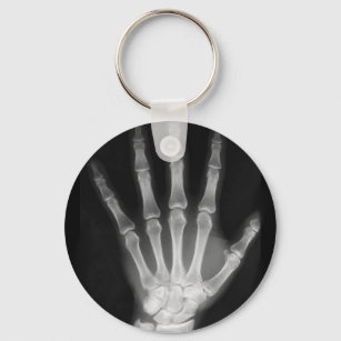 B&W Röntgen Skeleton Hand Schlüsselanhänger