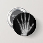 B&W Röntgenstrahl-Skelett-Hand Button (Vorne & Hinten)