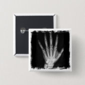 B&W Röntgenstrahl-Skelett-Hand Button (Vorne & Hinten)