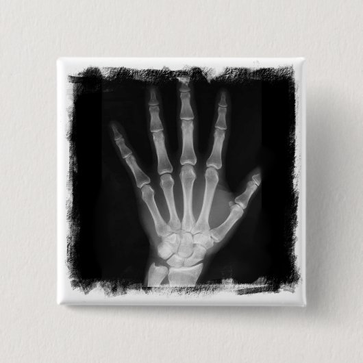 B&W Röntgenstrahl-Skelett-Hand Button (Vorderseite)