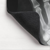 B&W Röntgenstrahl-Skelett-Hand Mousepad (Ecke)