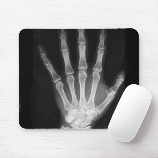 B&W Röntgenstrahl-Skelett-Hand Mousepad (Mit Mouse)