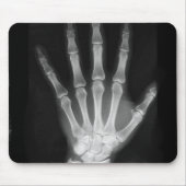 B&W Röntgenstrahl-Skelett-Hand Mousepad (Vorne)