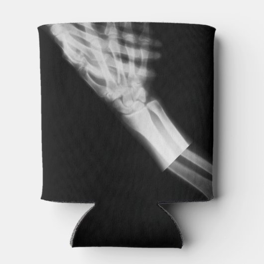 B&W X-Ray Skeleton Hand Shake Dosenkühler (Rückseite)