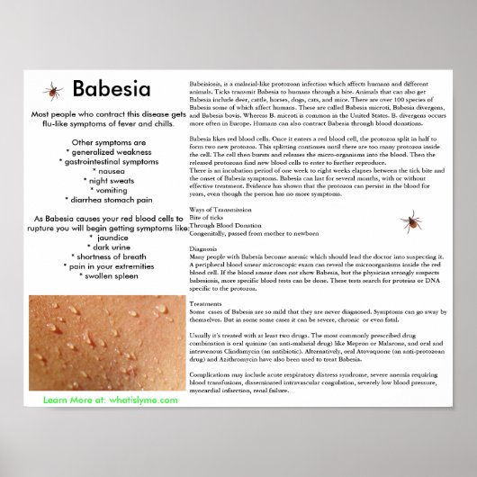 Babesia Symptome und Transmission Poster (Vorne)