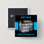 Baby Boy Ultrasound Foto Button (Vorne & Hinten)