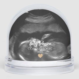 Baby Coming Bald Sonogram Gold-Herz Schneekugeln