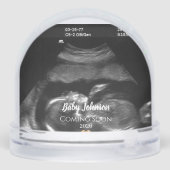 Baby Coming Bald Sonogram Gold-Herz Schneekugeln (Rückseite)