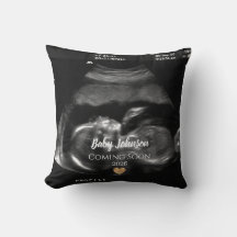 Baby Coming Bald Ultrasound Gold Herz