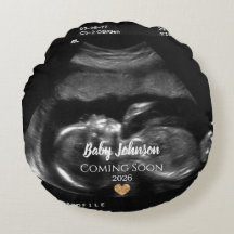 Baby Coming Bald Ultrasound Gold Herz