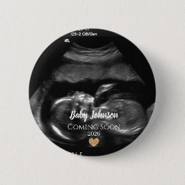 Baby Coming Soon Ultrasound Gold heart Button