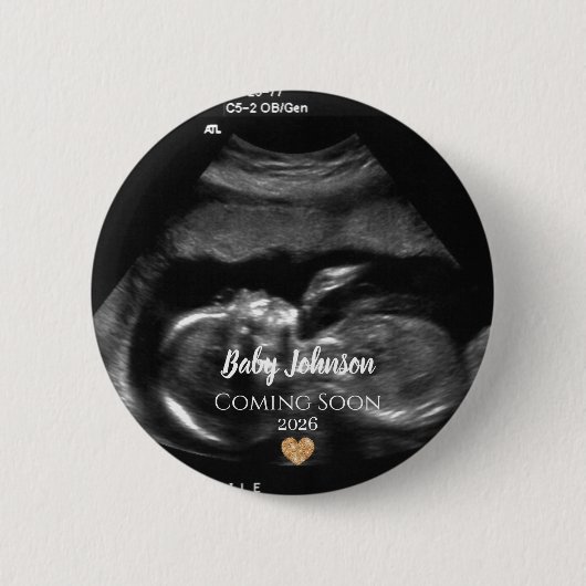 Baby Coming Soon Ultrasound Gold heart Button (Vorderseite)