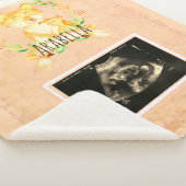 Baby Fox Custom Ultrasound Picture Sherpa Blanket Sherpadecke (3/4)