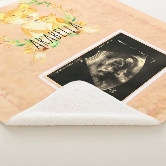 Baby Fox Custom Ultrasound Picture Sherpa Blanket Sherpadecke (3/4)