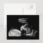 Baby Postkarte (Vorne/Hinten)