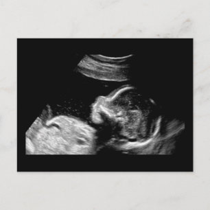 Baby Postkarte