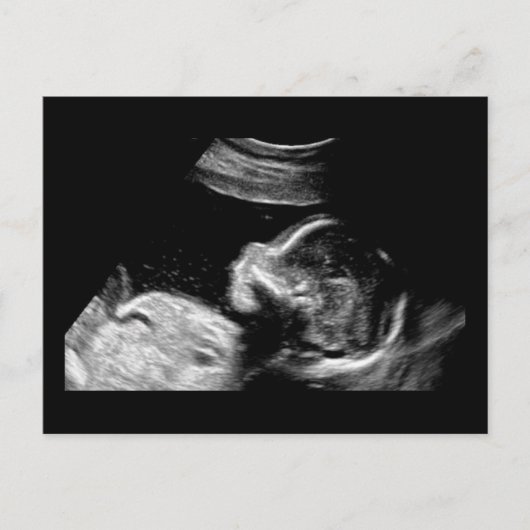 Baby Postkarte (Vorderseite)
