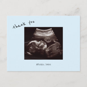 Baby-Shower-Ultraschall Süßes Eisblaues Danke Postkarte