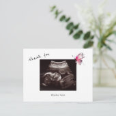 Baby Shower Ultrasound Cute Butterfly Thank You Postkarte (Stehend Vorderseite)