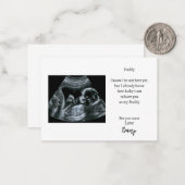 Baby Sonogram Card für Daddy Mitteilungskarte (Vorderseite/Rückseite Beispiel)