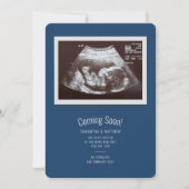 Baby Sonogram kommt bald Schwangerschaftsankündigu (Vorderseite)