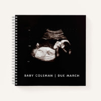 Baby Sonogram Personalisiert Memory Prenancy Book