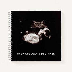 Baby Sonogram Personalisiert Memory Prenancy Book Notizblock