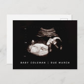 Baby Sonogram Pregnancy Ankündigung Foto Postkarte (Vorne/Hinten)