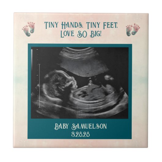 Baby Ultrasound Keepake Geschenkboxen Fliese (Vorderseite)