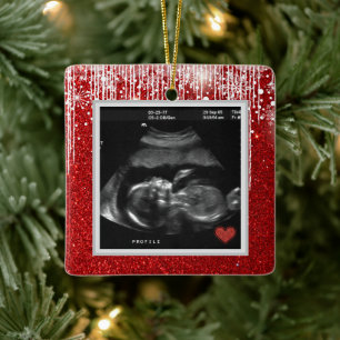 Baby Ultrasound kommt bald Foto Keramikornament