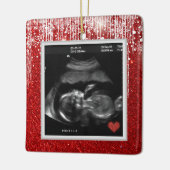 Baby Ultrasound kommt bald Foto Keramikornament (Links)