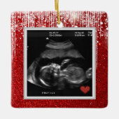 Baby Ultrasound kommt bald Foto Keramikornament (Vorderseite)