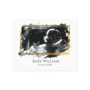 Baby Ultrasound Sonogram Picture erwartend  Leinwanddruck