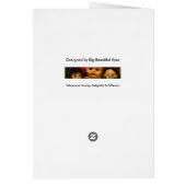 Babyboomer - Hüften, die ersetztes links und recht (Hinten)