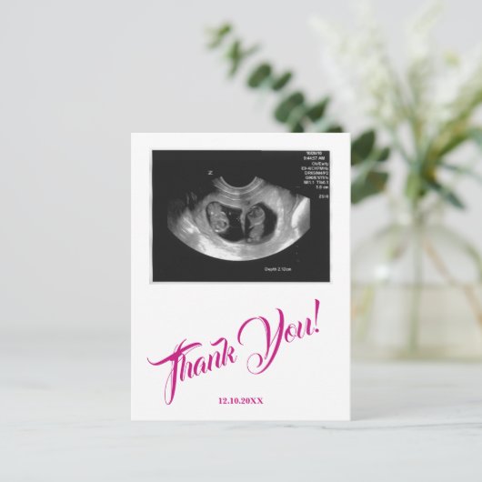 Babydusche Ultrasound Girl Pink Vielen Dank. Postkarte (Stehend Vorderseite)
