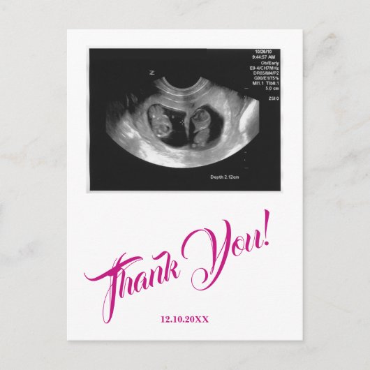 Babydusche Ultrasound Girl Pink Vielen Dank. Postkarte (Vorderseite)