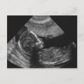 Babygesicht, Karte (Vorderseite)