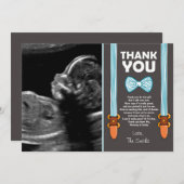 Babyparty danken Ihnen, kleines Mann-Echo zu Dankeskarte (Vorne/Hinten)