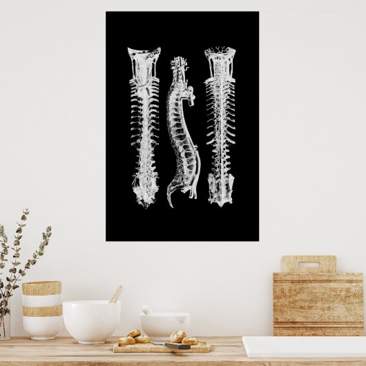 Backbone Anatomy Wall Decoder Medical Art Poster (Küche)
