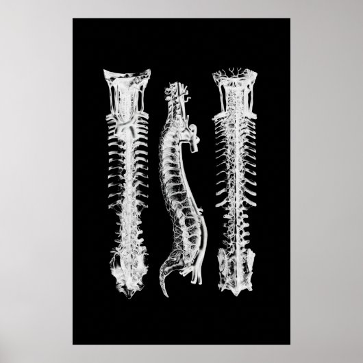 Backbone Anatomy Wall Decoder Medical Art Poster (Vorne)