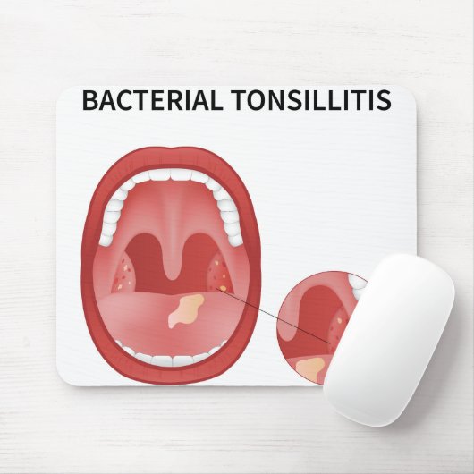 Bakterielle Tonsillitis Mousepad (Mit Mouse)