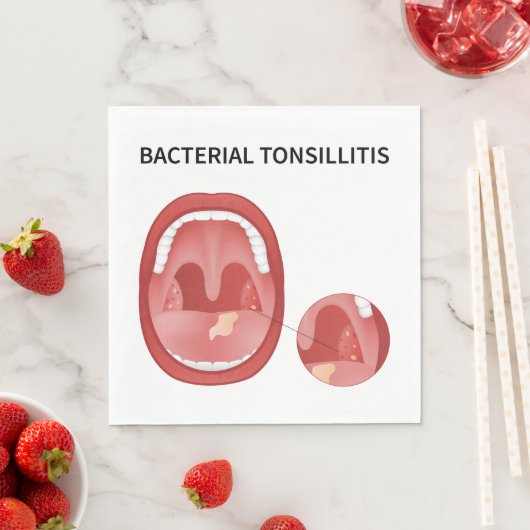 Bakterielle Tonsillitis Serviette (Beispiel)