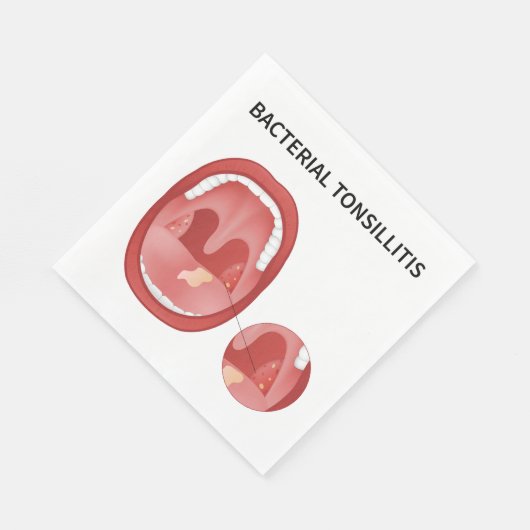 Bakterielle Tonsillitis Serviette (Ecke)
