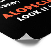 Bald Balding Alopecia Areata Haarausfall Problem A Poster (Ecke)