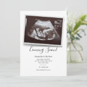 Bald kommen Skript Ultraschalluntersuchung Sonogra Ankündigung (Stehend Vorderseite)