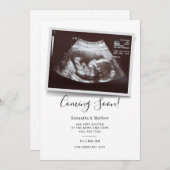 Bald kommen Skript Ultraschalluntersuchung Sonogra Ankündigung (Vorne/Hinten)