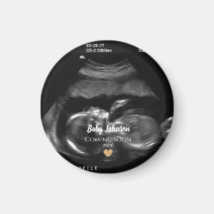 Bald kommt Baby Sonogramm-Ankündigung  Magnet
