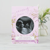 Bald kommt das UltraschallFoto Pink Gold Foliage Ankündigung (Stehend Vorderseite)