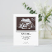 Bald kommt der Haushalt für die Ultraschalldiagnos (Stehend Vorderseite)